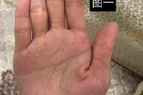 双手断掌的命运解析：揭示性格与人生的神秘联系