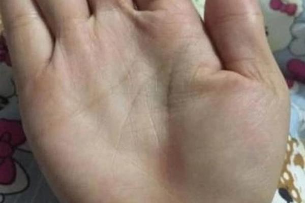 探秘右手多一个小指的命运之谜，揭示独特人生轨迹！