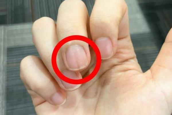 指甲形状与命运：揭示你的性格与运势之道