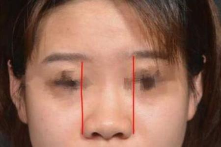 为什么女人有泪痣,命运会更加光彩夺目?