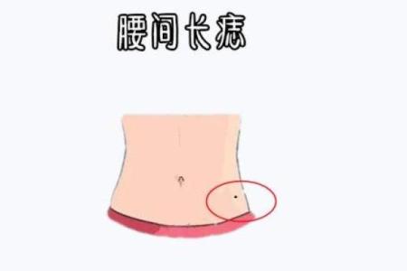 腿上有痣上辈子是什么命?一探身体痣的秘密与传说!
