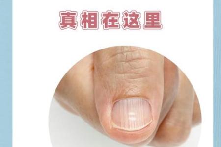 指甲凸起竖纹的女人:命运与健康的深刻解读与影响