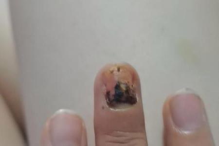 指甲剪断的背后:命运与象征的深刻启示