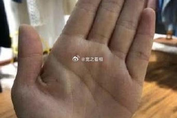 探秘女人手指上的痣：背后隐藏的命运与缘分