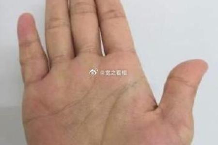 探秘女人手指上的痣:背后隐藏的命运与缘分