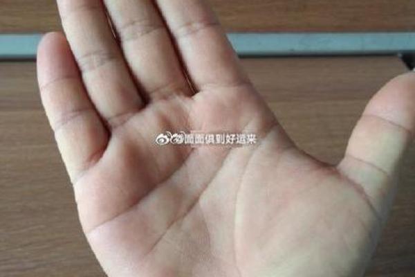 右手拇指有黑杠，揭秘命运背后的秘密！