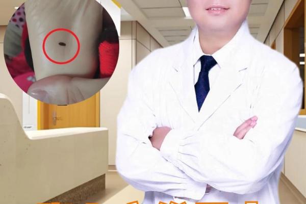 痣的秘密：全身长痣与命运的微妙关系揭示