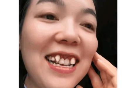 牙齿与命运:揭示30颗牙齿背后的寓意与人生哲学