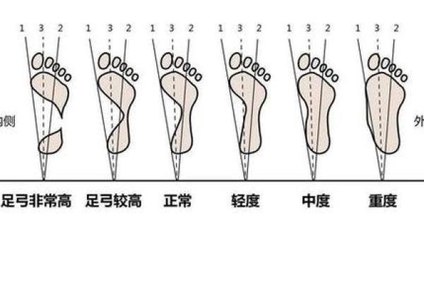 为什么平足的人命短？探索生理与健康的微妙关系