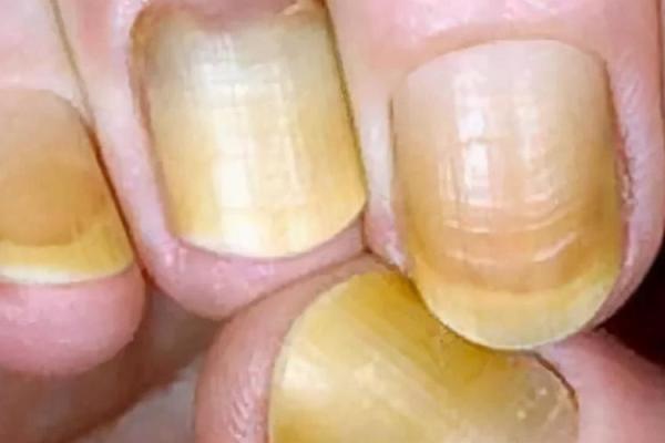 指甲特别长，命运特有玄机：探索指甲与性格的神秘联系